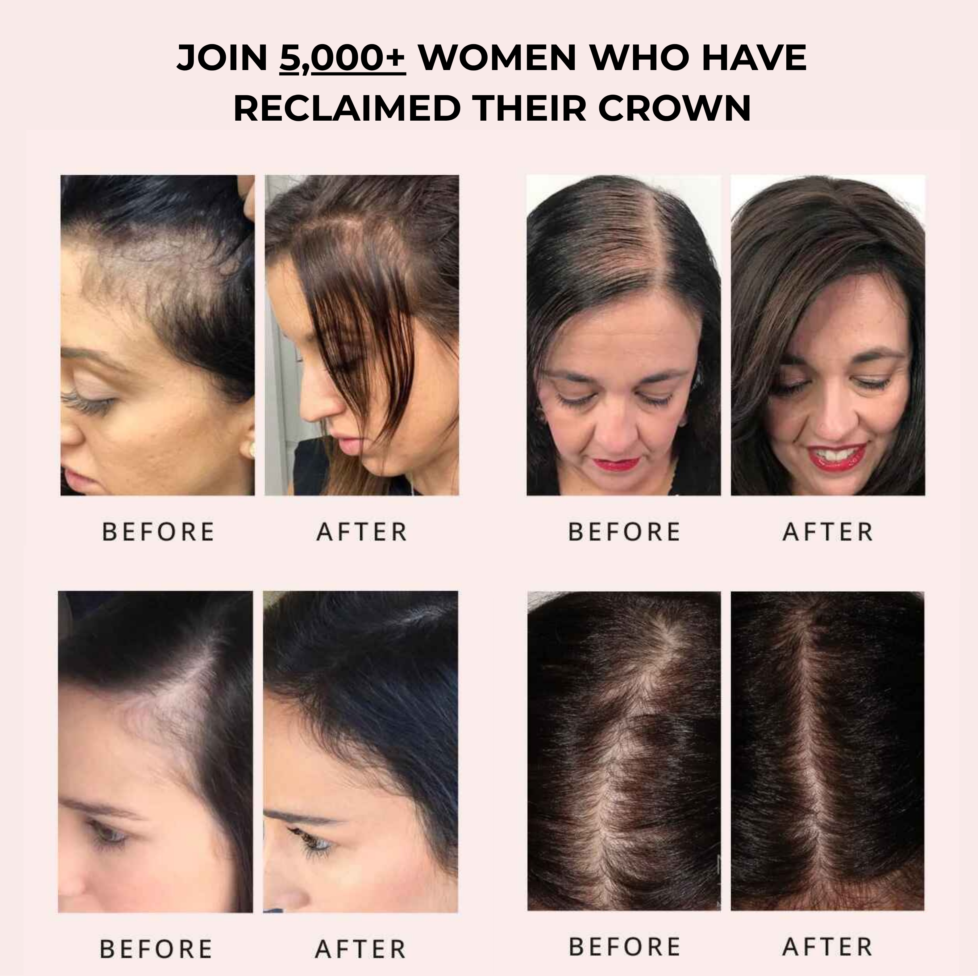 Solveene Hair Growth Serum