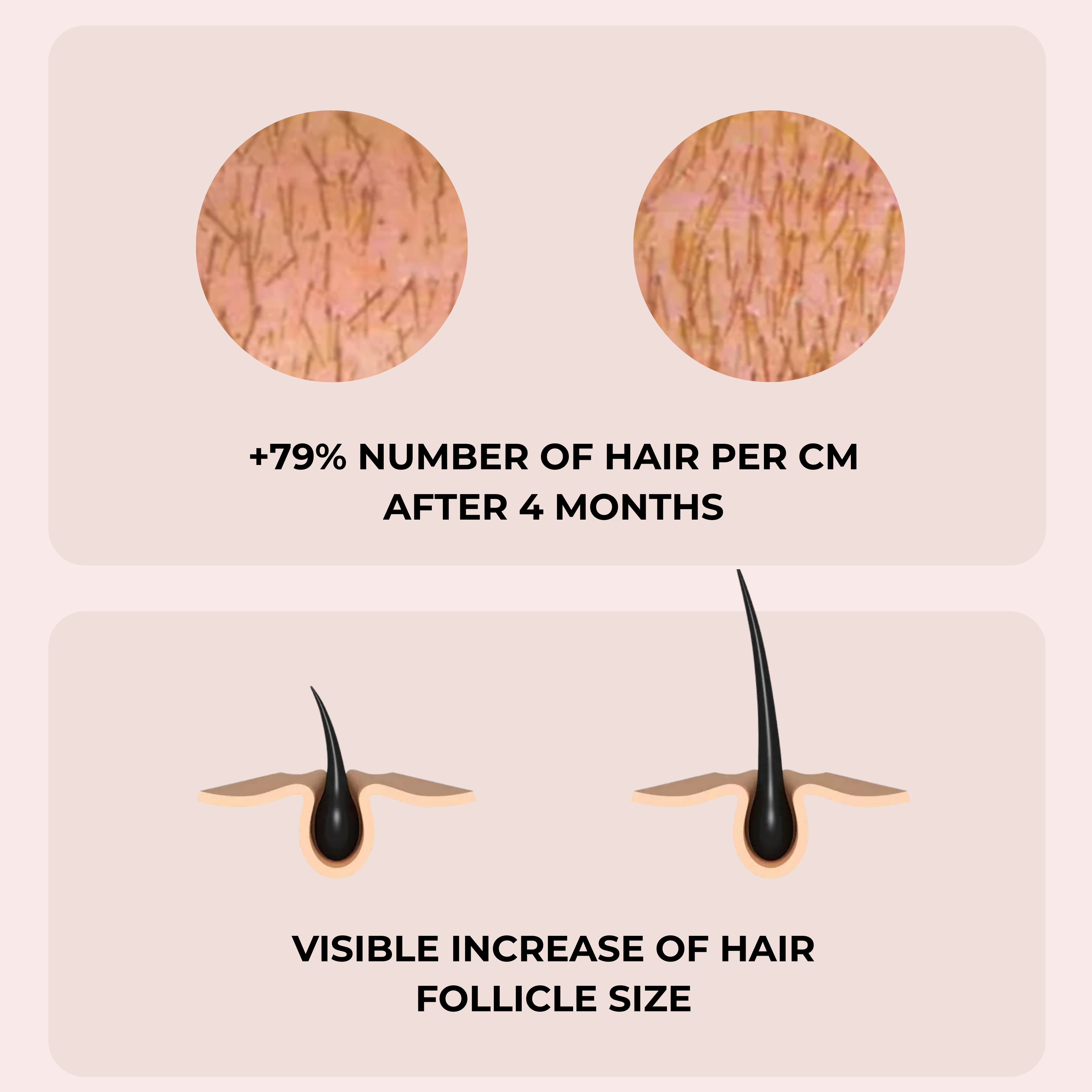 Solveene® Botanical Hair Growth Serum