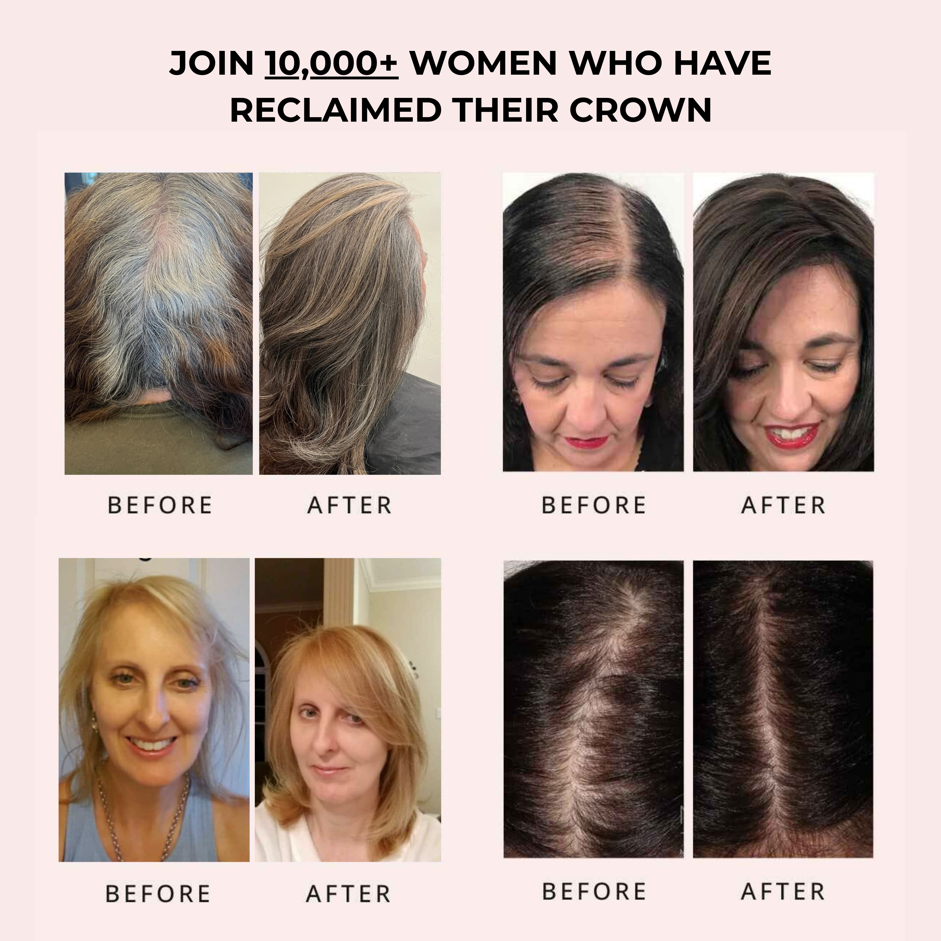 Solveene® Botanical Hair Growth Serum