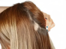 Shedding hair & bald spots